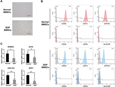 Systematic Analysis of mRNAs and ncRNAs in BMSCs of Senile Osteoporosis Patients